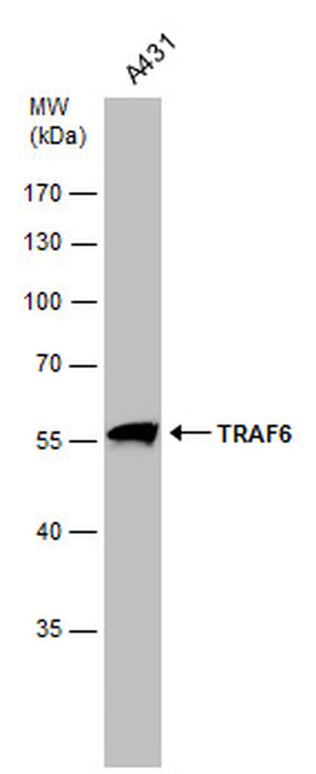 TRAF6 Antibody in Western Blot (WB)