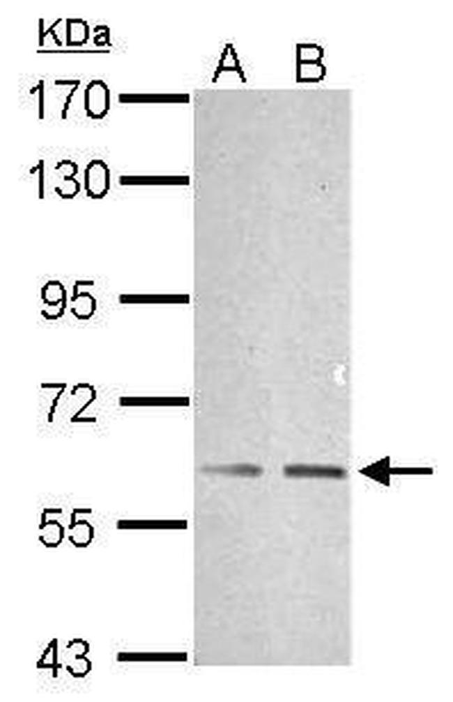 TRAF6 Antibody in Western Blot (WB)