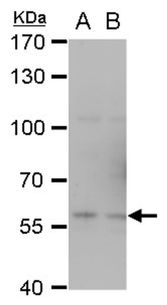 TRAF6 Antibody in Western Blot (WB)