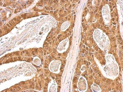 VCP Antibody in Immunohistochemistry (Paraffin) (IHC (P))