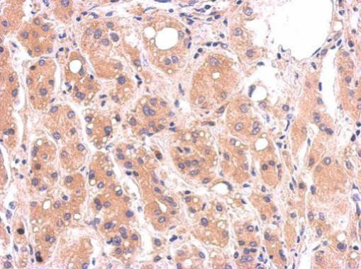 DIABLO Antibody in Immunohistochemistry (Paraffin) (IHC (P))