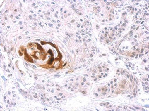 Arginase 1 Antibody in Immunohistochemistry (Paraffin) (IHC (P))