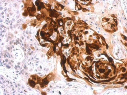 Arginase 1 Antibody in Immunohistochemistry (Paraffin) (IHC (P))