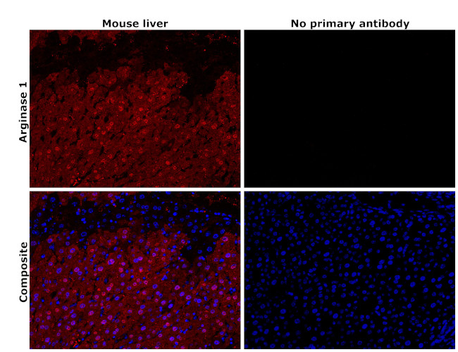 Arginase 1 Antibody in Immunohistochemistry (Paraffin) (IHC (P))