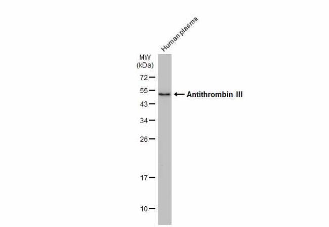 SERPINC1 Antibody in Western Blot (WB)