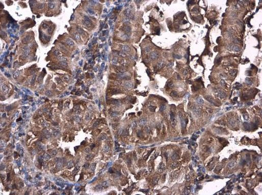 Caspase 10 Antibody in Immunohistochemistry (Paraffin) (IHC (P))