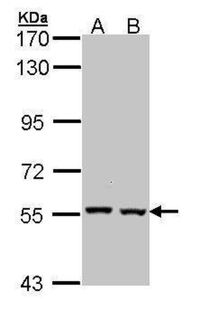 Catalase Antibody in Western Blot (WB)