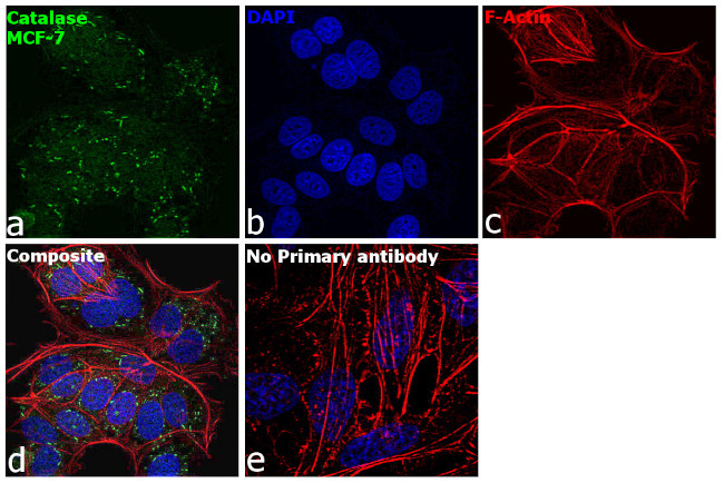 Catalase Antibody in Immunocytochemistry (ICC/IF)