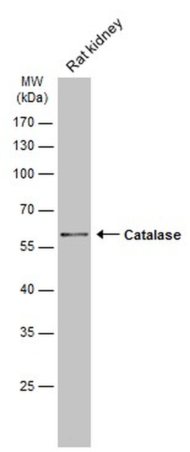 Catalase Antibody in Western Blot (WB)