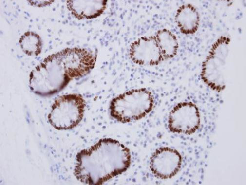 CDX2 Antibody in Immunohistochemistry (Paraffin) (IHC (P))