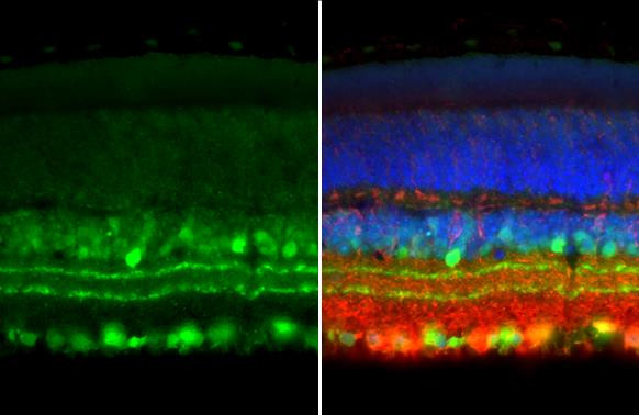 ChAT Antibody in Immunohistochemistry (Paraffin) (IHC (P))