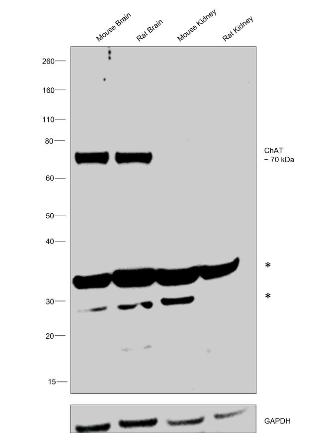 ChAT Antibody in Western Blot (WB)