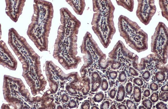 ChAT Antibody in Immunohistochemistry (Paraffin) (IHC (P))