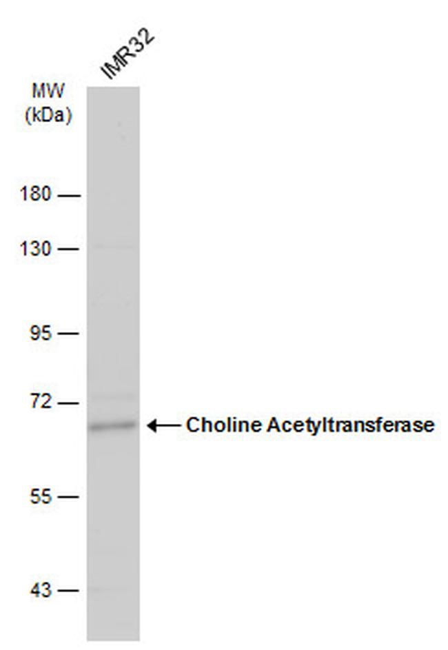 ChAT Antibody in Western Blot (WB)