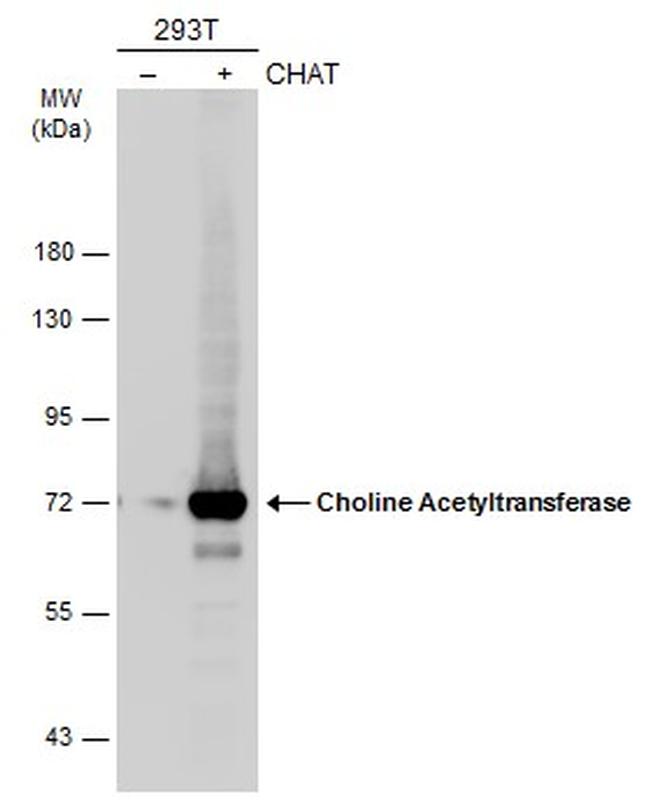 ChAT Antibody in Western Blot (WB)