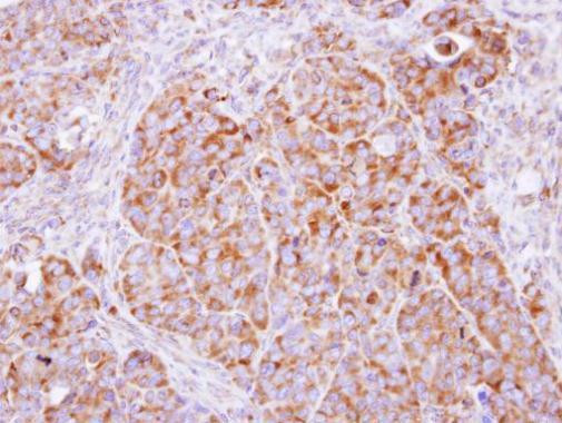 beta COP Antibody in Immunohistochemistry (Paraffin) (IHC (P))