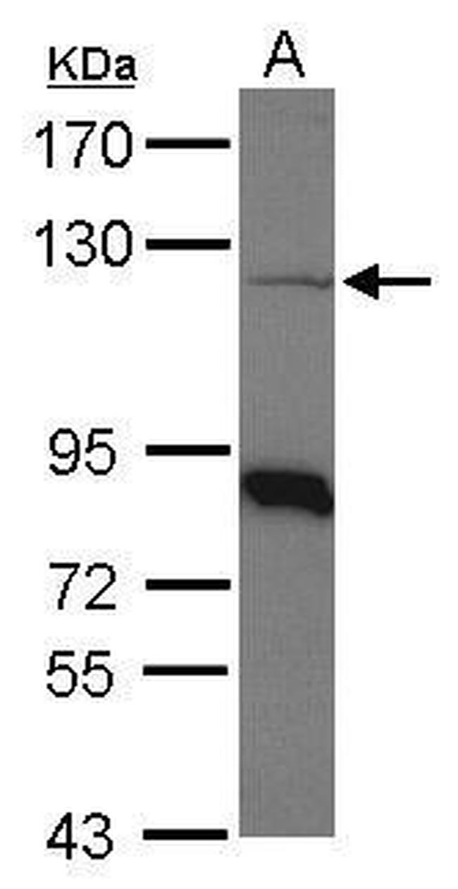 beta COP Antibody in Western Blot (WB)