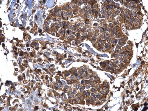 Dynamin 2 Antibody in Immunohistochemistry (Paraffin) (IHC (P))