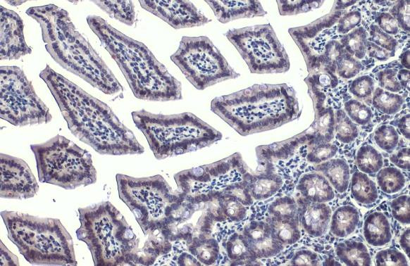 GATA4 Antibody in Immunohistochemistry (Paraffin) (IHC (P))