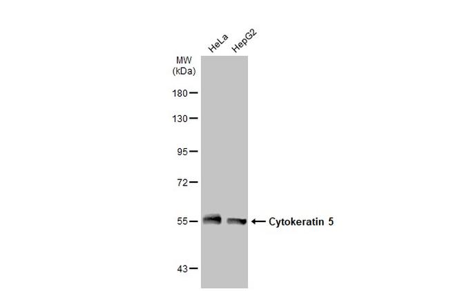 Cytokeratin 5 Antibody in Western Blot (WB)