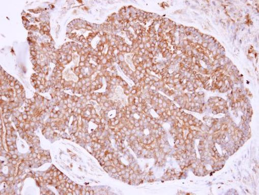 MYH9 Antibody in Immunohistochemistry (Paraffin) (IHC (P))