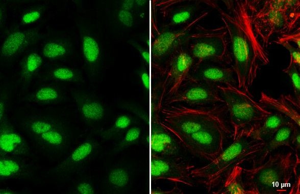 PBX1 Antibody in Immunocytochemistry (ICC/IF)