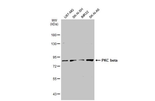 PKC beta Antibody in Western Blot (WB)