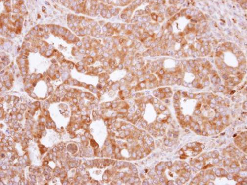 RAC2 Antibody in Immunohistochemistry (Paraffin) (IHC (P))