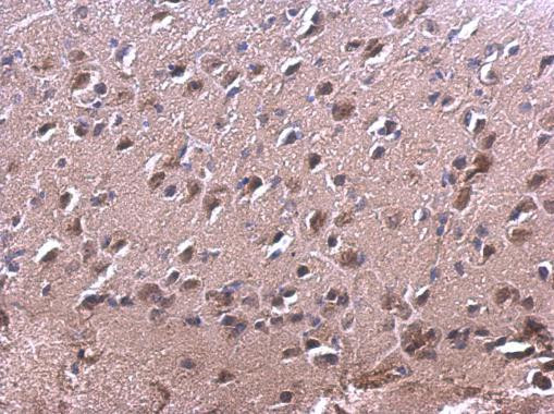 RAC2 Antibody in Immunohistochemistry (Paraffin) (IHC (P))