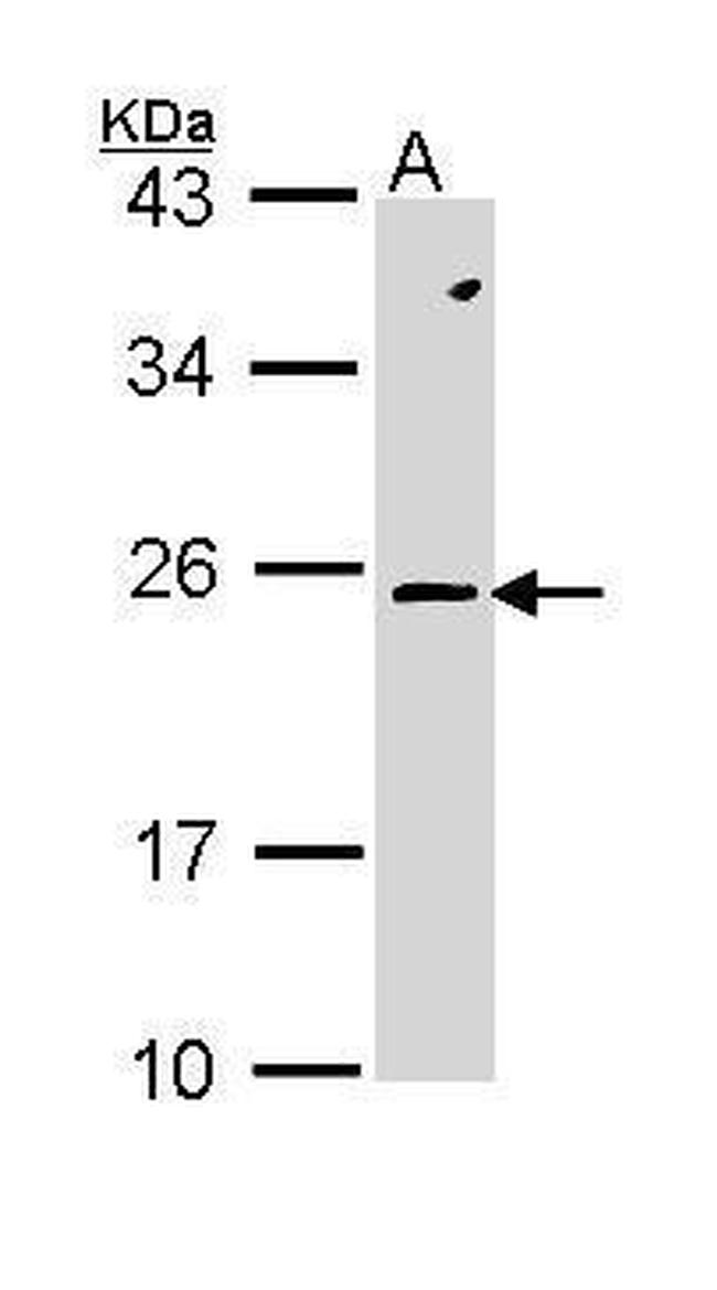 RAC2 Antibody in Western Blot (WB)