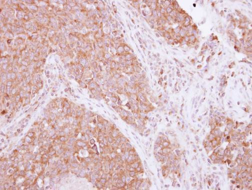 SIAH1 Antibody in Immunohistochemistry (Paraffin) (IHC (P))