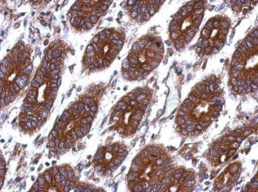 TK1 Antibody in Immunohistochemistry (Paraffin) (IHC (P))