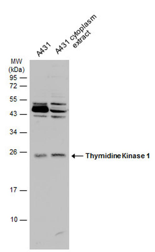 TK1 Antibody in Western Blot (WB)