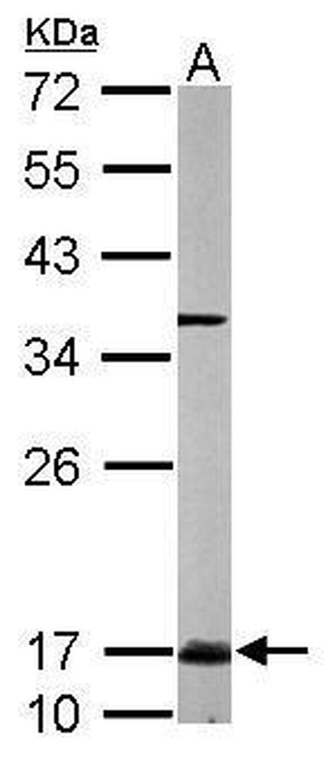 UBC13 Antibody in Western Blot (WB)