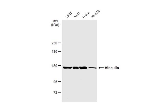 Vinculin Antibody in Western Blot (WB)