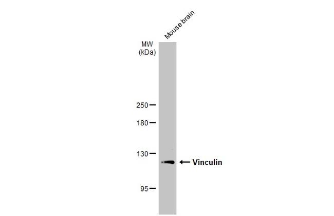 Vinculin Antibody in Western Blot (WB)