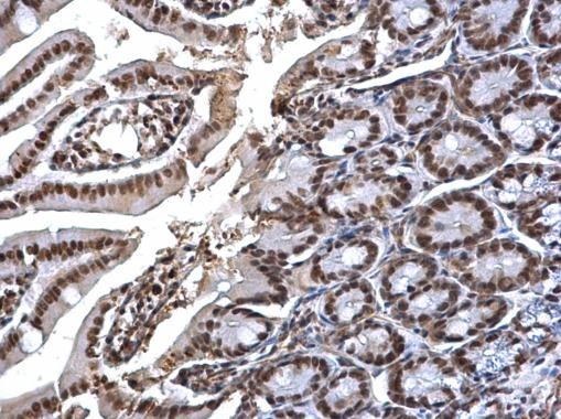 SMC1 Antibody in Immunohistochemistry (Paraffin) (IHC (P))