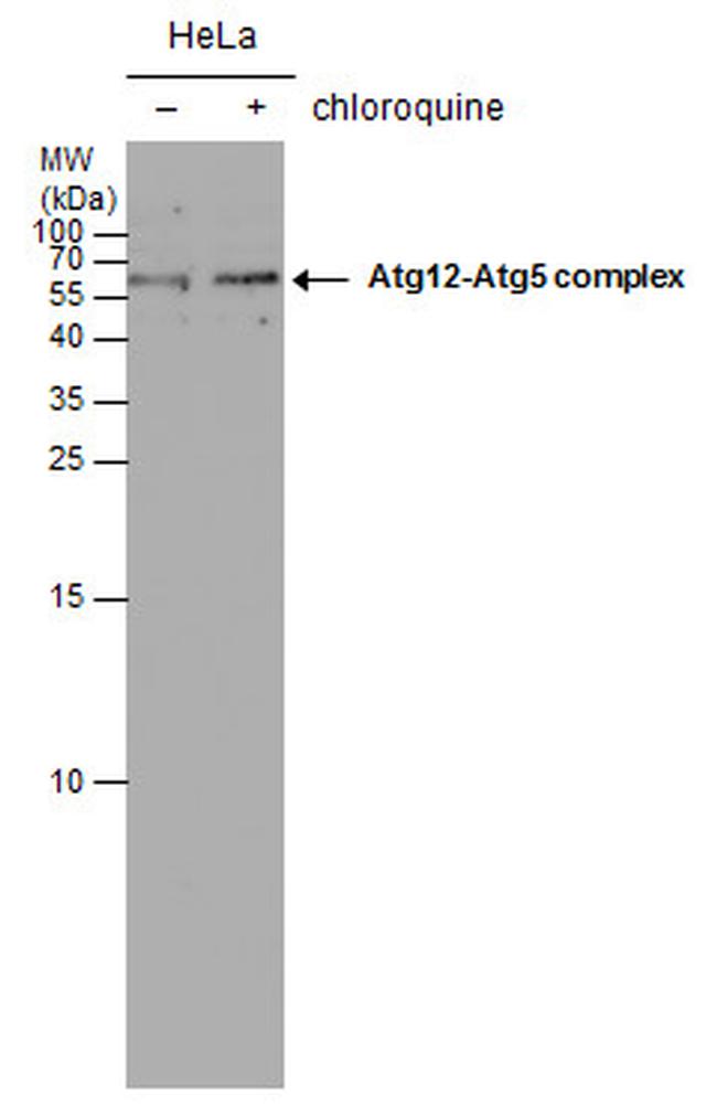 ATG5 Antibody in Western Blot (WB)