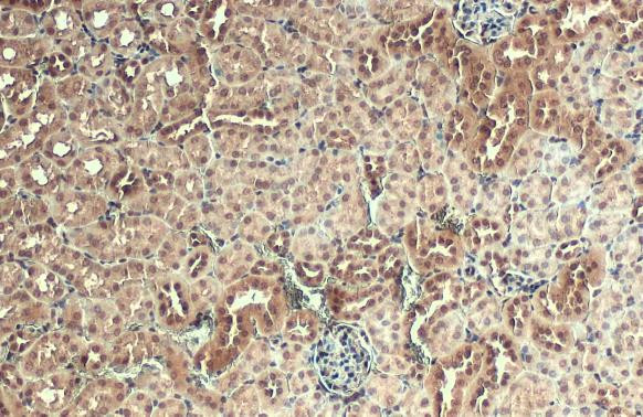 AKT3 Antibody in Immunohistochemistry (Paraffin) (IHC (P))