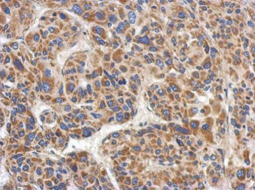 RACGAP1 Antibody in Immunohistochemistry (Paraffin) (IHC (P))