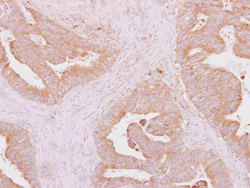 IRAK4 Antibody in Immunohistochemistry (Paraffin) (IHC (P))