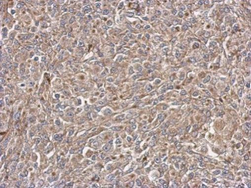 IRAK4 Antibody in Immunohistochemistry (Paraffin) (IHC (P))