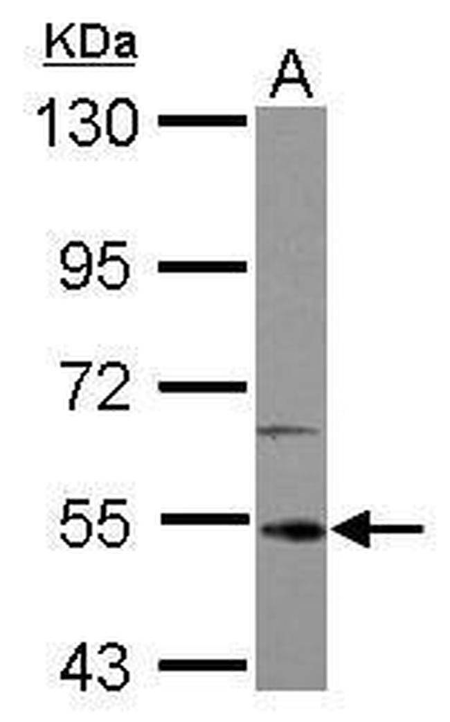 IRAK4 Antibody in Western Blot (WB)