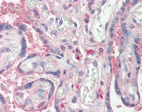 WWOX Antibody in Immunohistochemistry (Paraffin) (IHC (P))