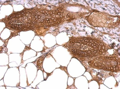 WWOX Antibody in Immunohistochemistry (Paraffin) (IHC (P))