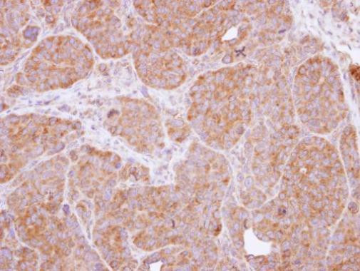 CARD11 Antibody in Immunohistochemistry (Paraffin) (IHC (P))