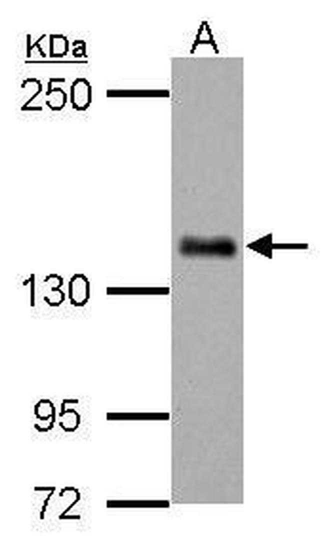 CARD11 Antibody in Western Blot (WB)