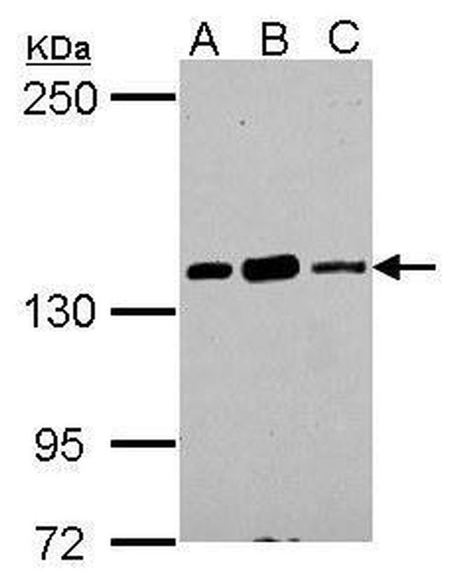 CARD11 Antibody in Western Blot (WB)