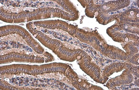 GRP78 Antibody in Immunohistochemistry (Paraffin) (IHC (P))