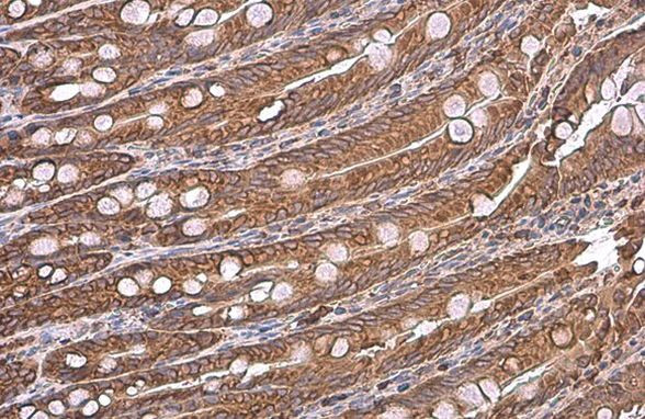 GRP78 Antibody in Immunohistochemistry (Paraffin) (IHC (P))